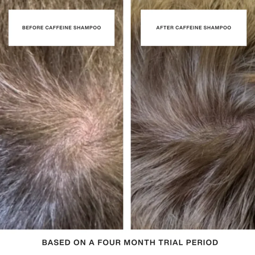 The Thicker Hair Trio - Image 7